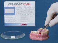 Miniatura 2 de CERASORB Foam (Moldável)-Matriz reabsorvível de fosfato β-tricálcico de fase pura + colágeno
