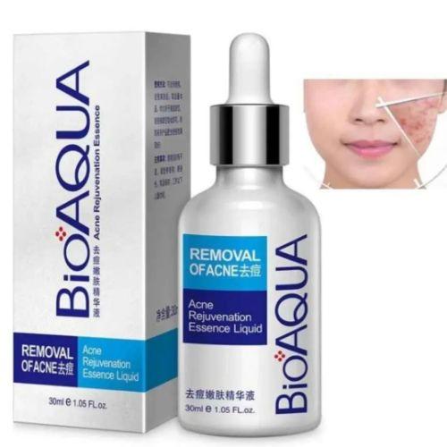Bioaqua Serun para rostro antiacne 30ml