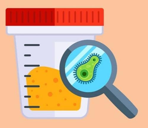 Examen general de orina