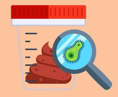 Examen general heces