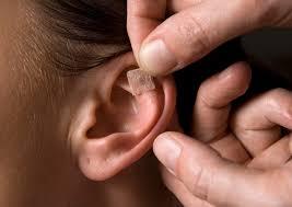 Puntos chinos para adelgazar (auriculoterapia)