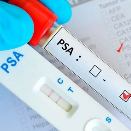 Imagen 1 de ANTÍGENO