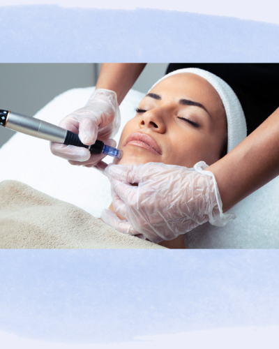 Imagen 1 de 3 Sesiones de Dermapen