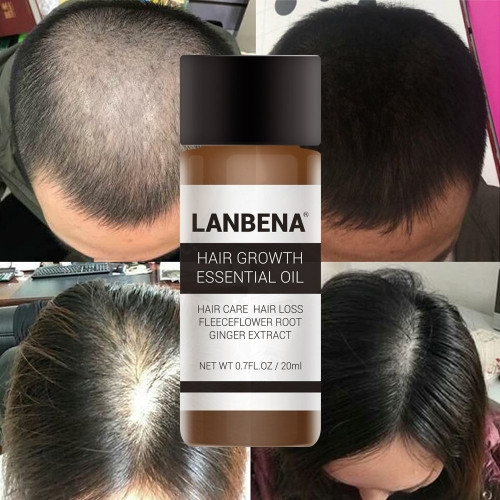 Imagen 1 de Aceite esencial para el crecimiento del cabello LB7426