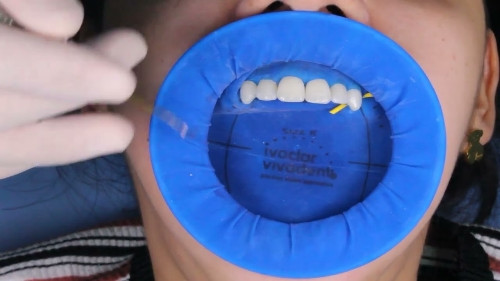 Imagen 1 de Abre bocas Optradam Dique de goma