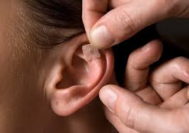 Imagen 1 de Puntos chinos para adelgazar (auriculoterapia)