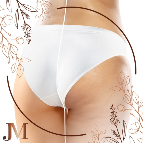 Imagen 1 de Cero Celulitis