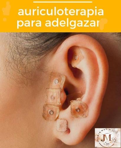 Imagen 1 de Auriculoterapia 