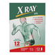 X  RAY DOL (ACETAMINOFEN-NAPROXENO-CAFEINA)X UNIDAD GENOMA