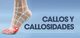 D1REMOVEDOR DE CALLOS POR MEDIDAS