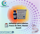 Adhesivo para cubetas, frasco de 30ml, Master Dent