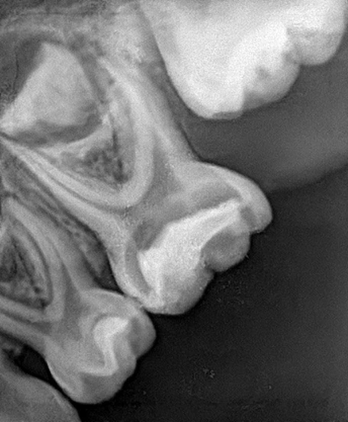 radiografia